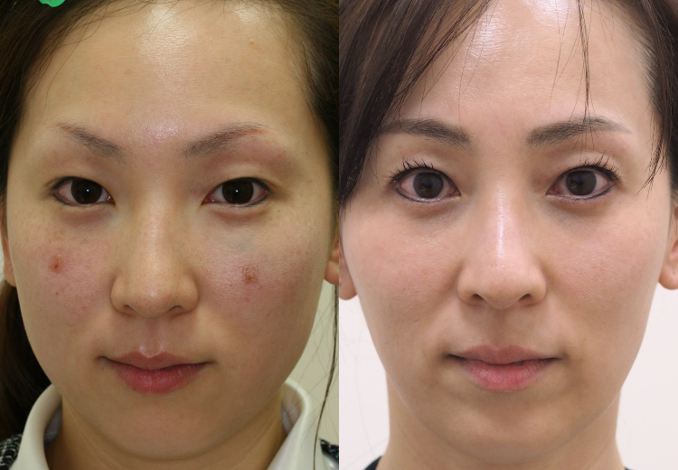10年前の写真との比較