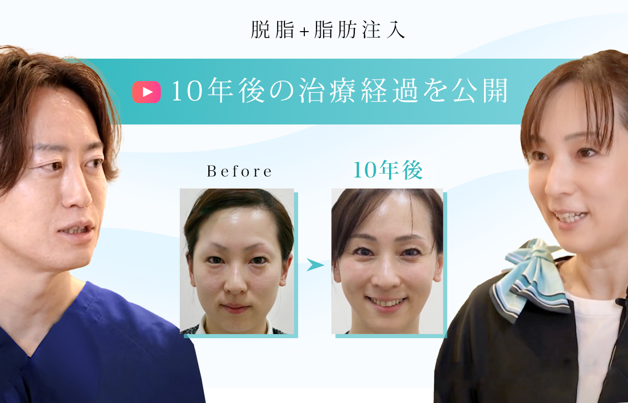 脱脂+脂肪注入はどれくらい持続する？