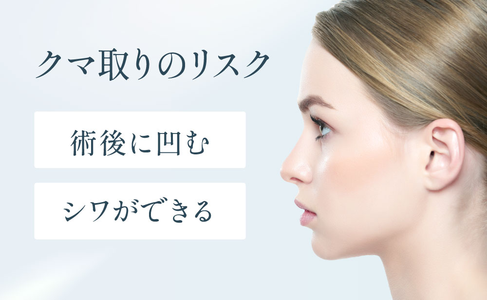 クマ取りのリスク