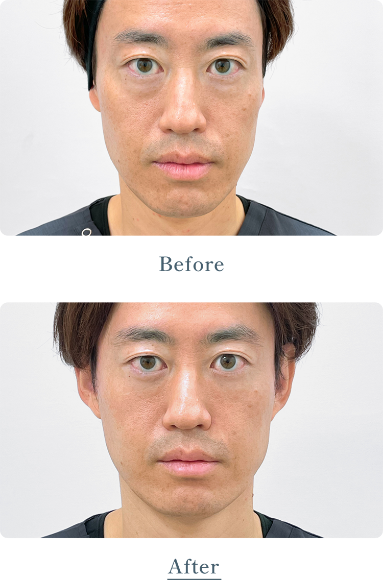 治療のBefore、After