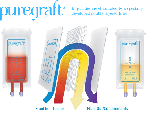 Impurities are eliminated by a specially developed double-layered filter 