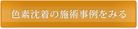 色素沈着のの術じ事例をみる